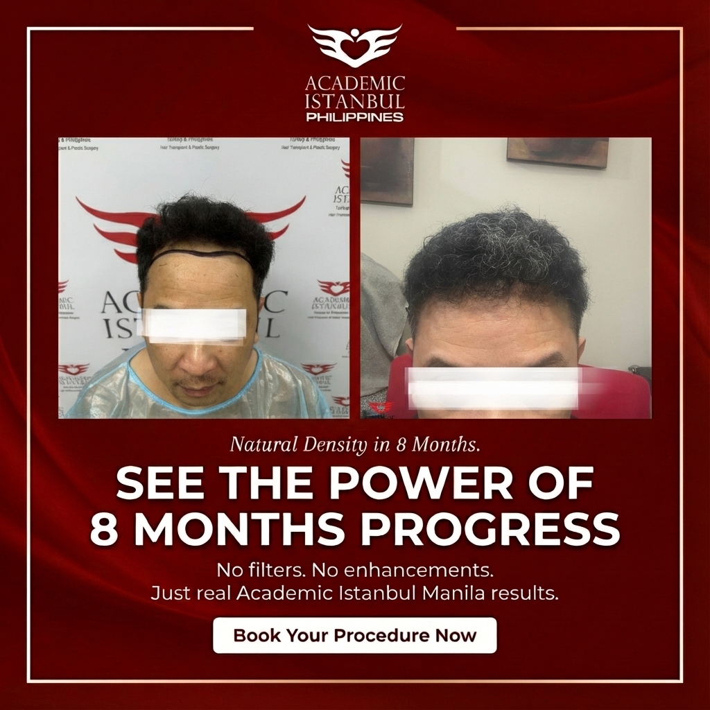 Natural density in 8 months.