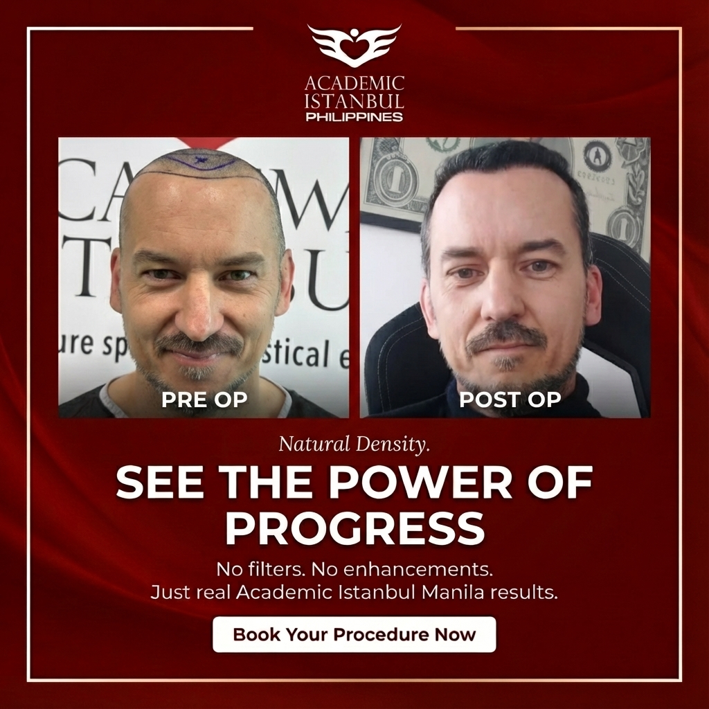 Natural density — pre-op vs post-op.